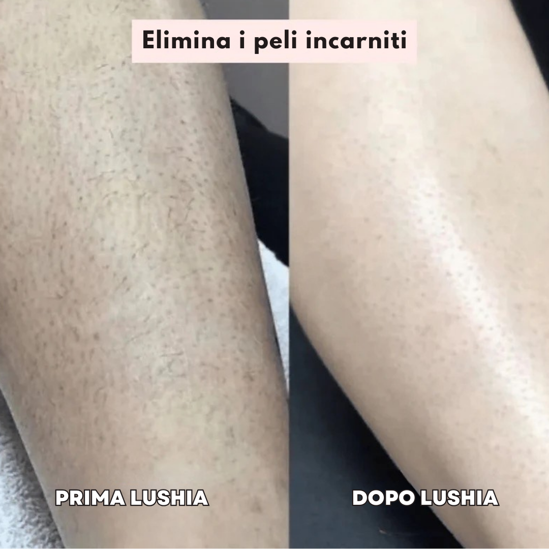 Rasoio Lushia® – La soluzione delicata per tutte le zone sensibili