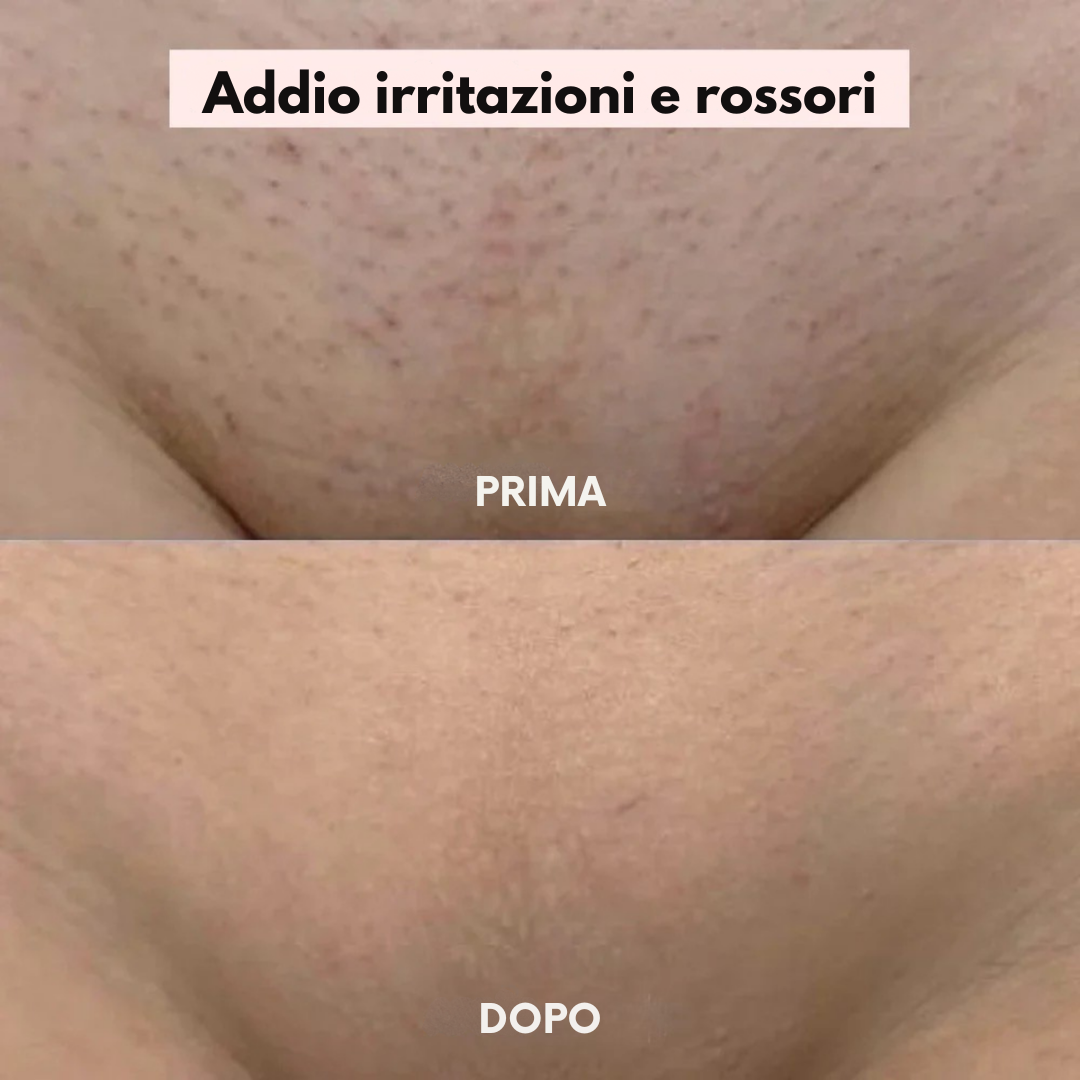 Rasoio Lushia® – La soluzione delicata per tutte le zone sensibili