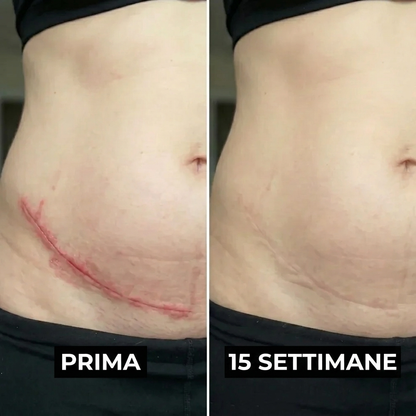 Stick Riparatore di Cicatrici con Silicone Medicale – Leviga e Riduce i Segni Visibili