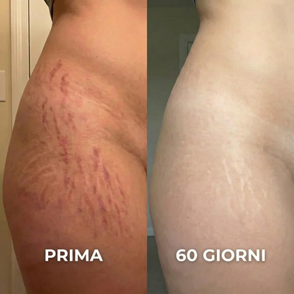 Stick Riparatore di Cicatrici con Silicone Medicale – Leviga e Riduce i Segni Visibili
