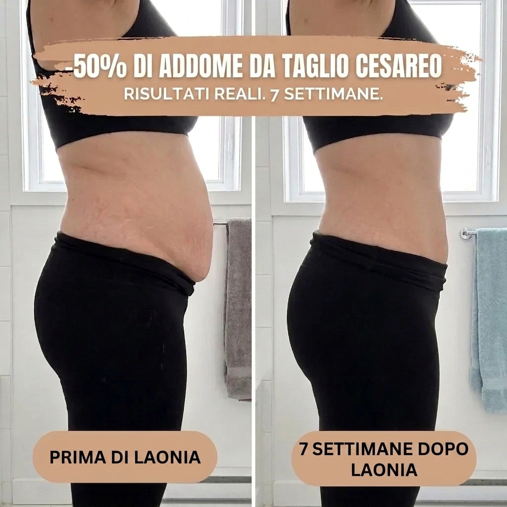 Culotte post parto a compressione 360°